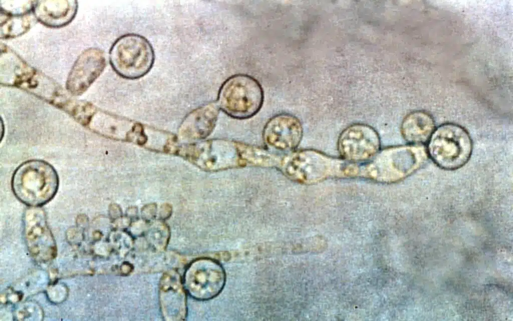 Candida albicans (GrahamColm/Wikimedia Commons)