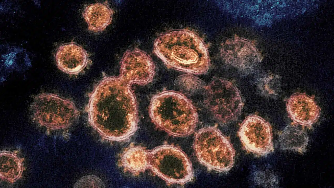 Natural Immunity to SARS-CoV-2